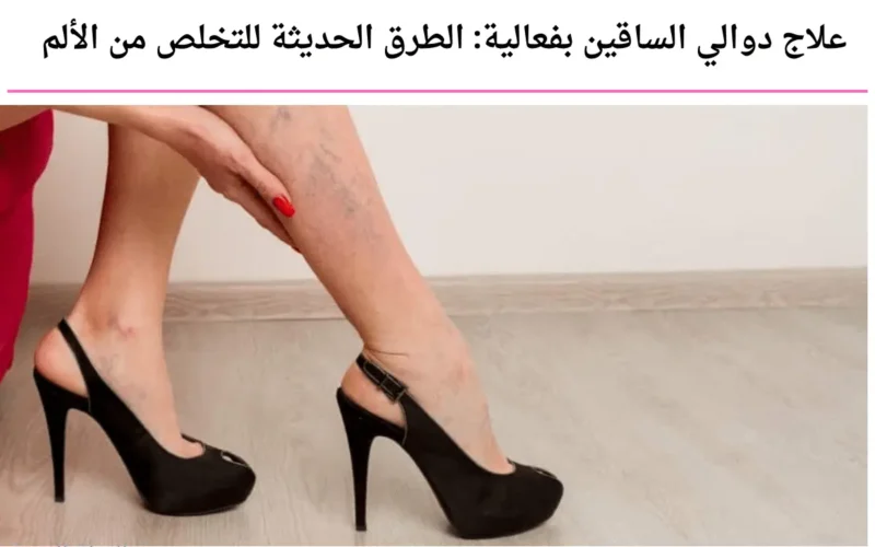 علاج دوالي الساقين بفعالية: الطرق الحديثة للتخلص من الألم