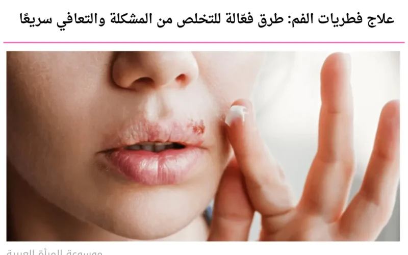 علاج فطريات الفم: طرق فعّالة للتخلص من المشكلة والتعافي سريعًا