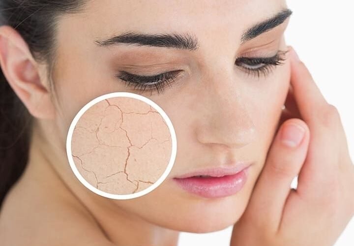 أقنعة للوجه الجاف: أفضل الماسكات لترطيب عميق واستعادة نعومة البشرة